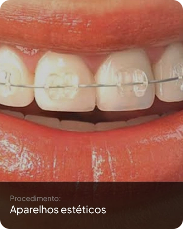 Aparelhos estéticos