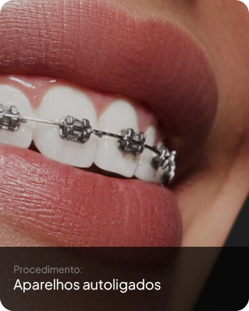 Aparelhos auto ligados